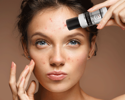 acne treatment on young skin