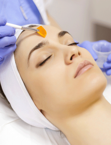 woman getting a chemical peel