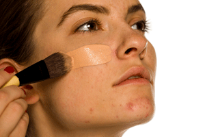 makeup concealer on bad skin